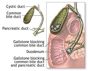 Gallbladder image